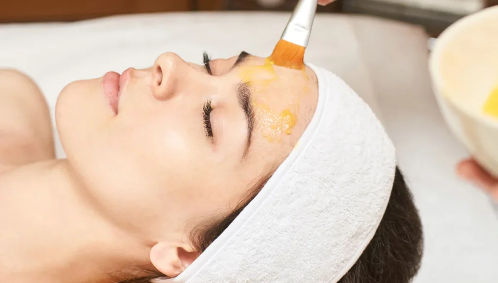 Chemical Peels in Houston