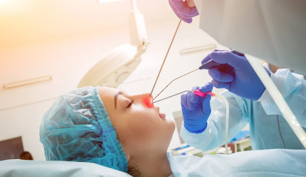 Nasal Polyp Surgery