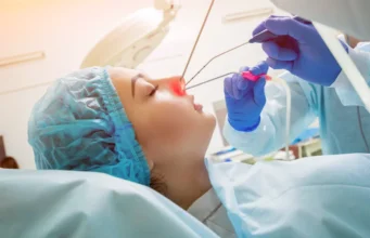 How Long Is Nasal Polyp Surgery? A Quick Guide for Patients Nasal Polyp Surgery