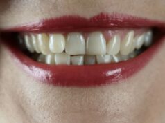 Dental Emergencies Covered by CDCP: What Ottawa Residents Need to Know Dental emergencies