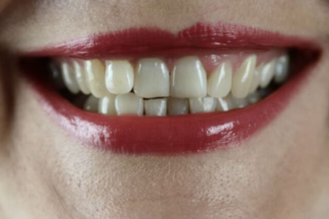 Dental emergencies
